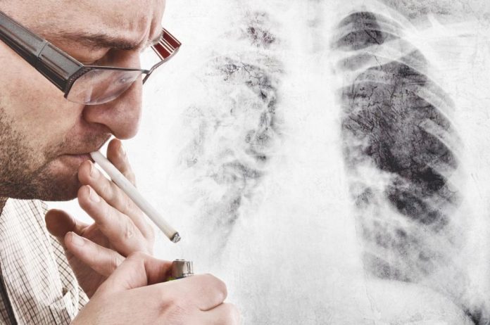 Ny test avslører lungekreft